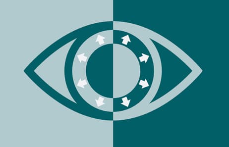 Glaucoma